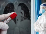 В Днепре больше всего »тяжелых» больных COVID-19 с начала пандемии, реанимация не выдерживает