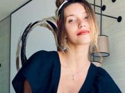 «Я все время замазывала, либо просила оператора снимать определенный кадр или вырезать»: Тодоренко снялась в фотосессии, не став скрывать пятна витилиго на ноге