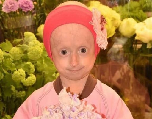 Мама умершей девочки-старушки из Винницы: Прости, что не смогла тебя спасти