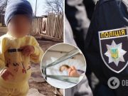 У 2-летнего мальчика, которого порезал отчим, умер мозг: мама рассказала о трагедии. Видео