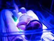 Фототерапія для новонароджених: особливості процедури і лампи для неї