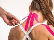 Кинезиотейпы: какой механизм лечения, основные преимущества