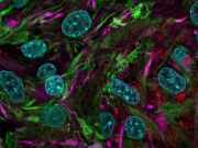 Исследователи разрабатывают «биокомпьютеры» на основе органоидов мозга