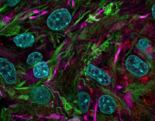 Исследователи разрабатывают «биокомпьютеры» на основе органоидов мозга